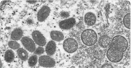 博瑞生物推出猴痘病毒数字PCR与荧光PCR检测试剂盒，助力科学战“痘”